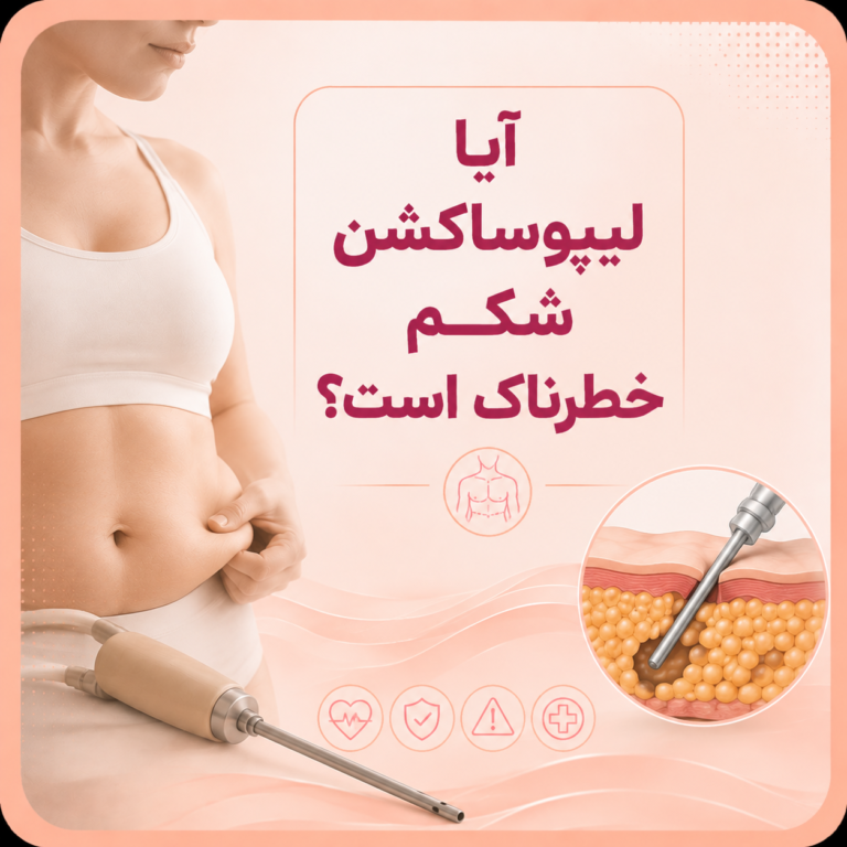 آیا لیپوساکشن شکم خطرناک است؟