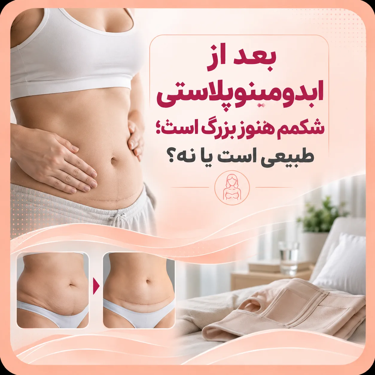 بعد از ابدومینوپلاستی شکمم هنوز بزرگ است؛ طبیعی است یا نه؟